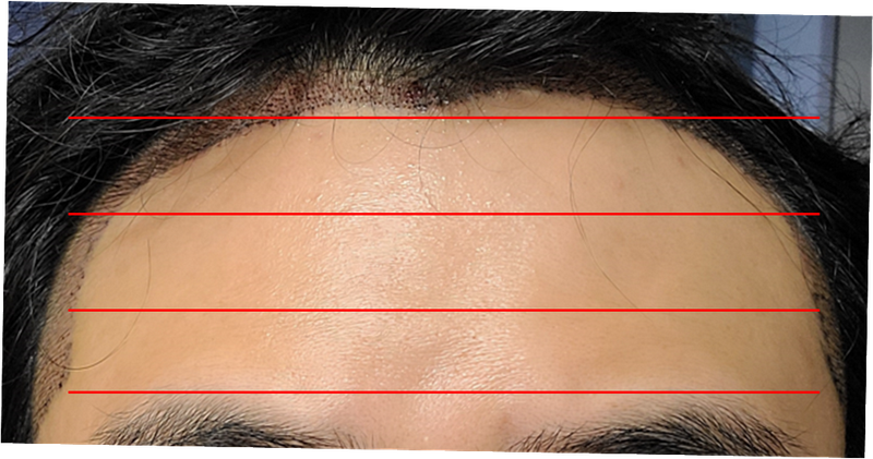그림1.png