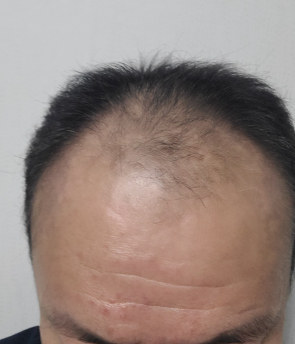 화면 캡처 2025-12-16 110928.png