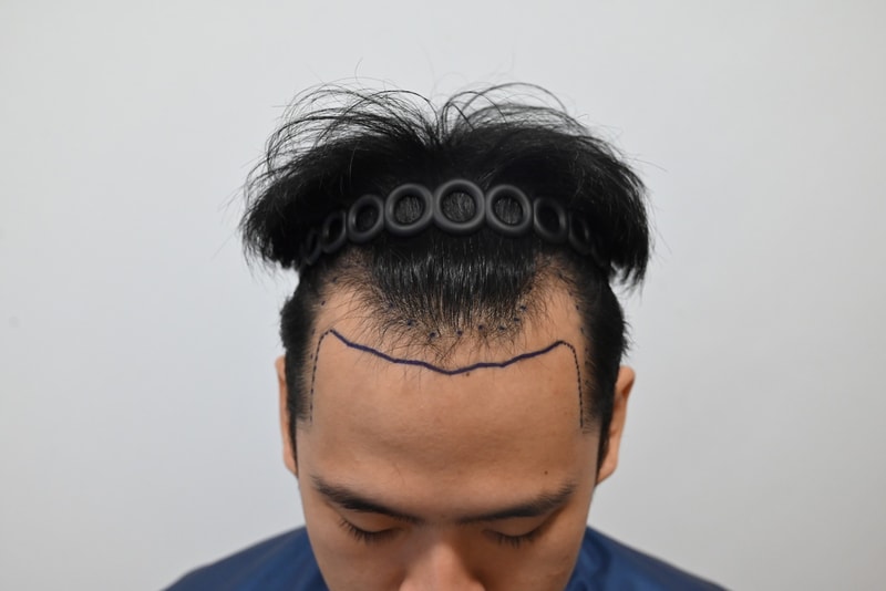 1000007640.jpg