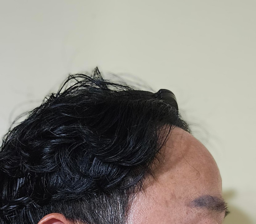 후