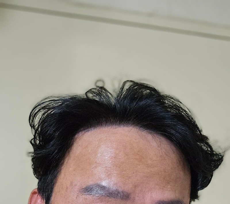 후1.jpg