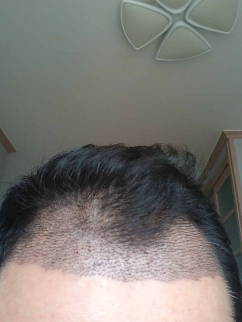 1000001766.jpg