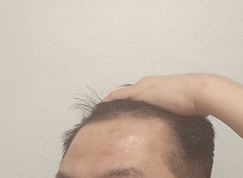전.png