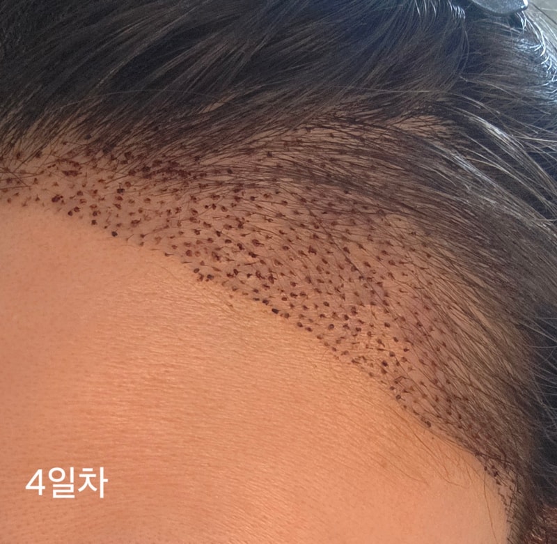 1000009295.jpg