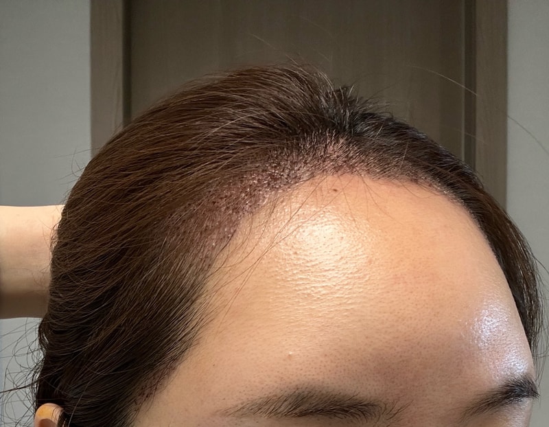 2KakaoTalk_20250403_104735651_03 (3).jpg