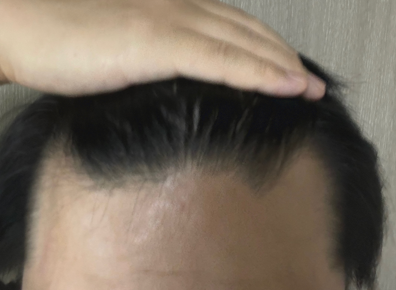 앞전.png