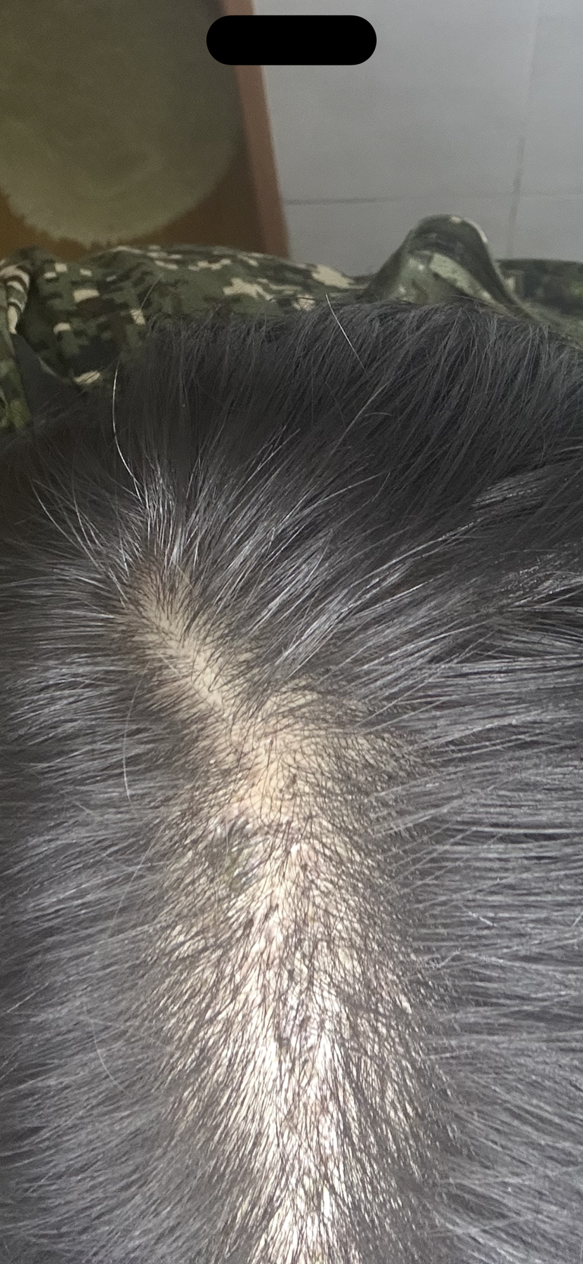 18일차