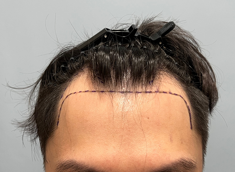 앞(전).png