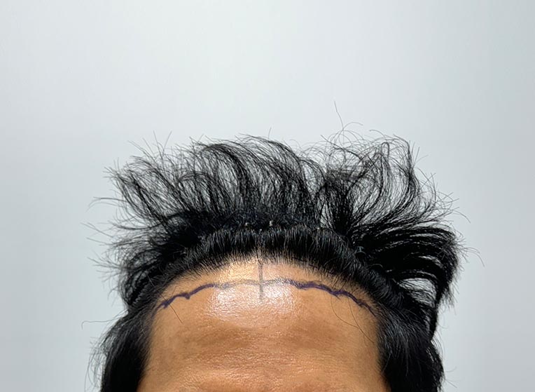앞(후).jpg