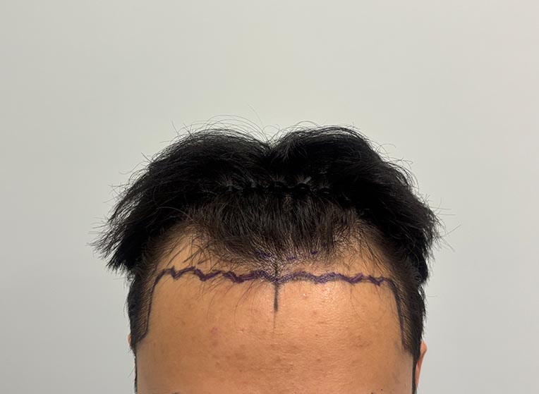 앞(전).jpg