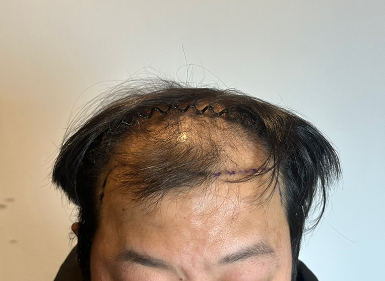 앞(전).png