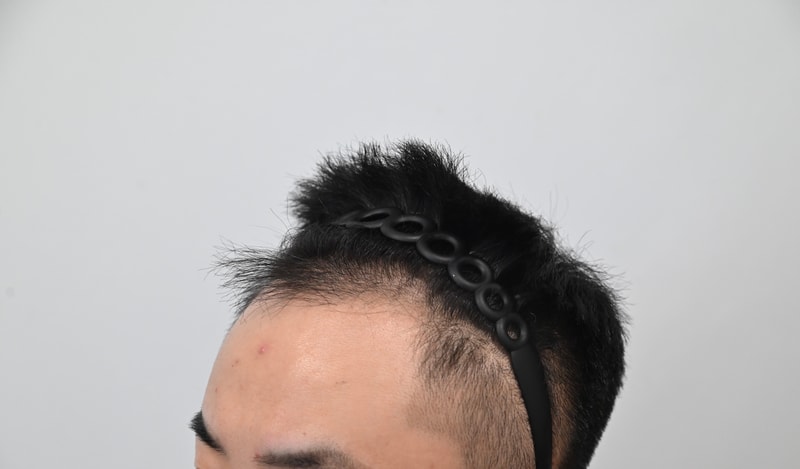 수술전2.jpg