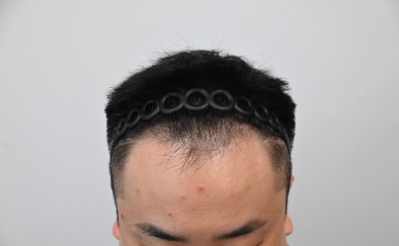 수술전3.jpg