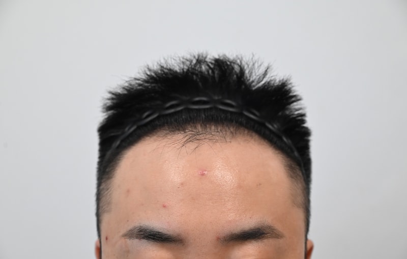 수술전4.jpg