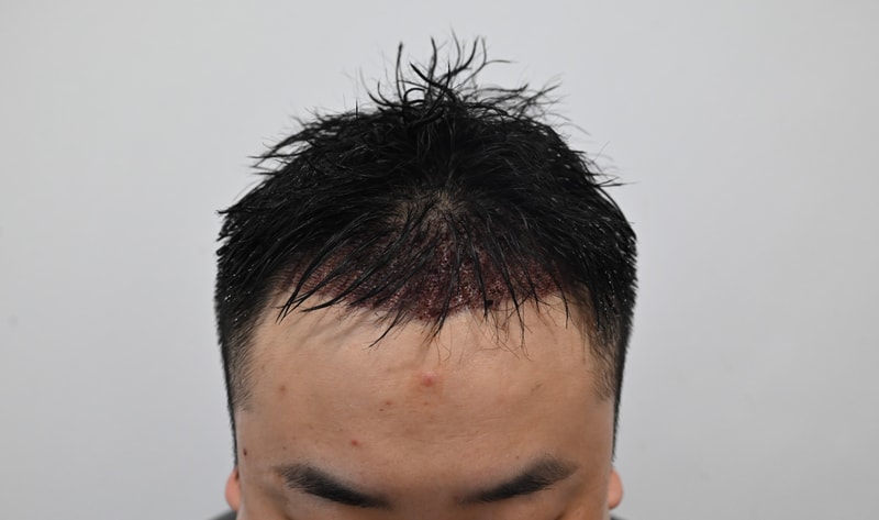 수술후1.jpg