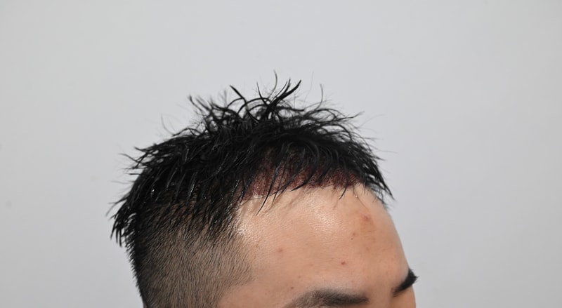 수술후2.jpg