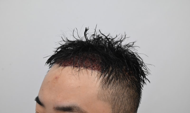 수술후3.jpg