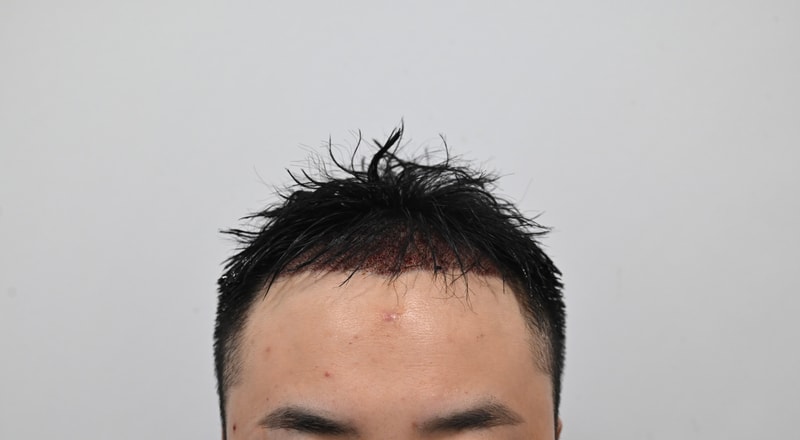 수술후4.jpg