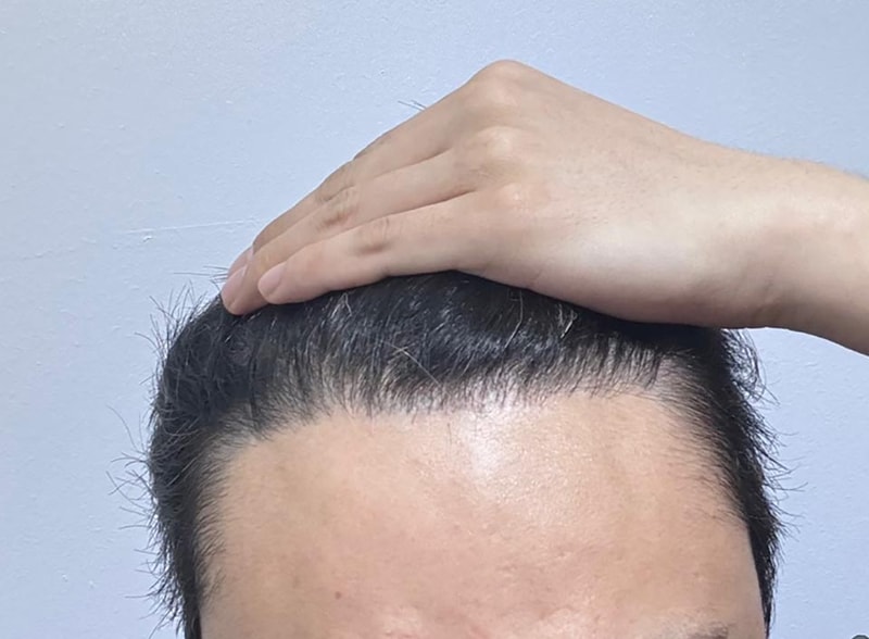 후1.jpg