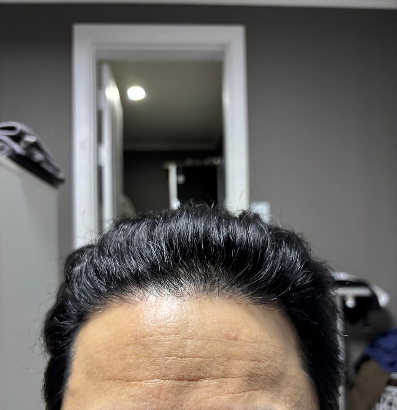 후1.jpg
