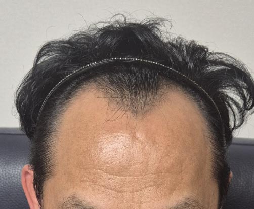 전1.jpg