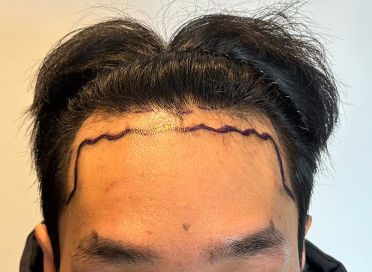 앞(전).png
