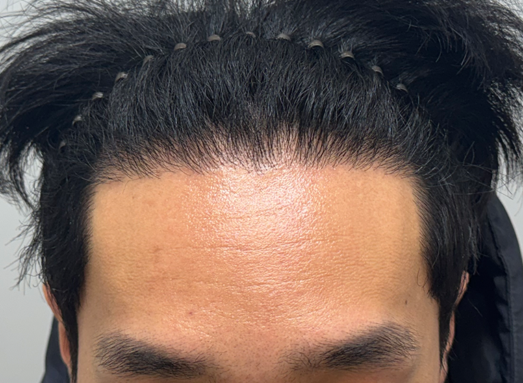 앞(후).png