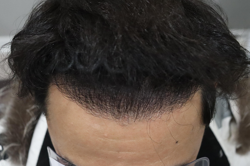 4.png
