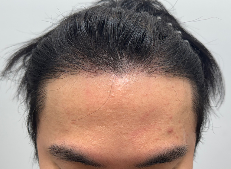 앞(후).png