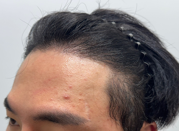 옆(후).png