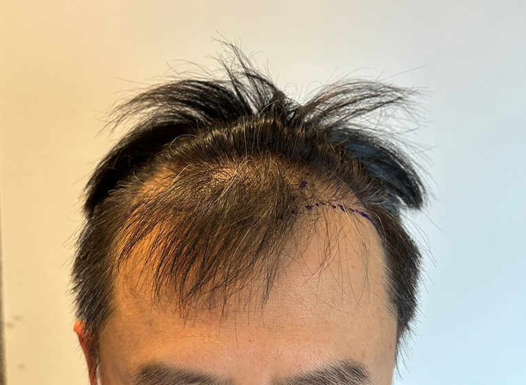 앞(전).png