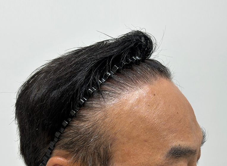 옆(후).png