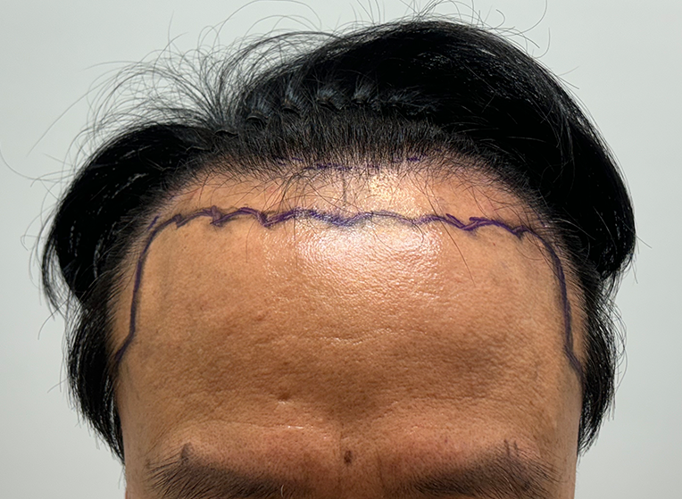 앞(전).png