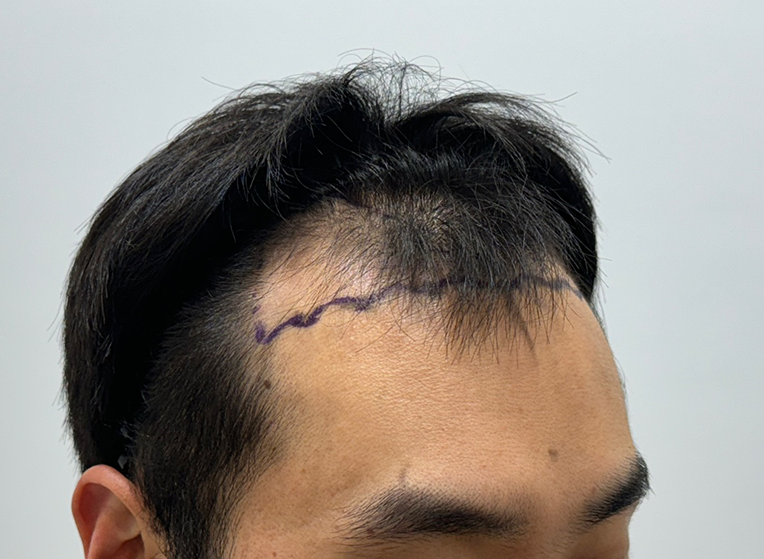 옆(전).png