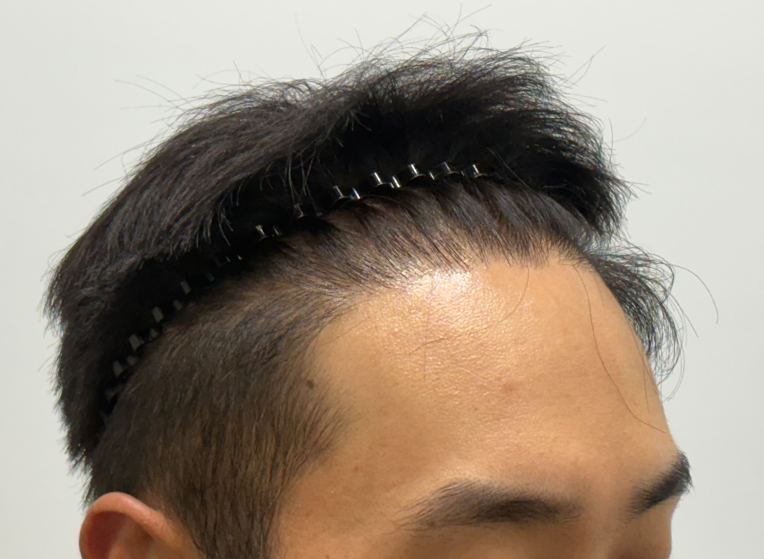 옆(후).png