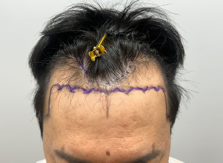 앞(전).png