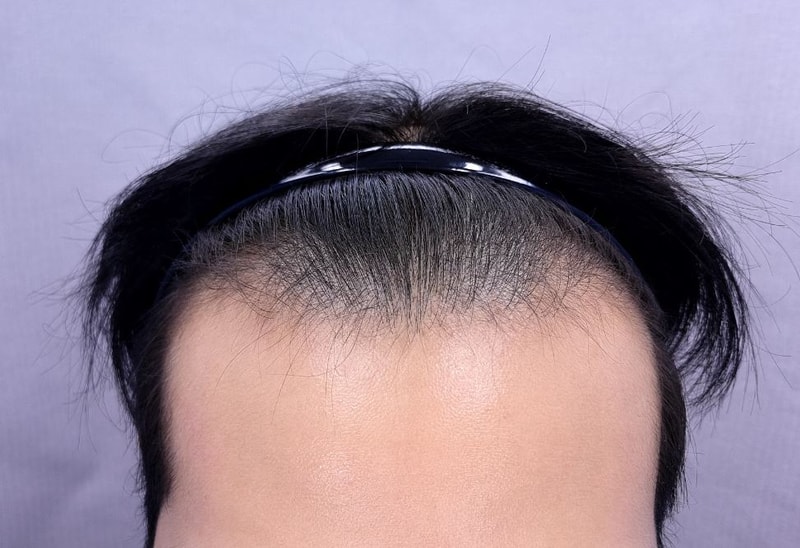 김0서 2500 h.l 6mo (5).JPG