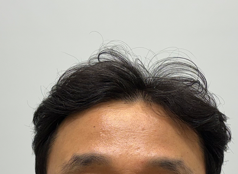 앞(후).png