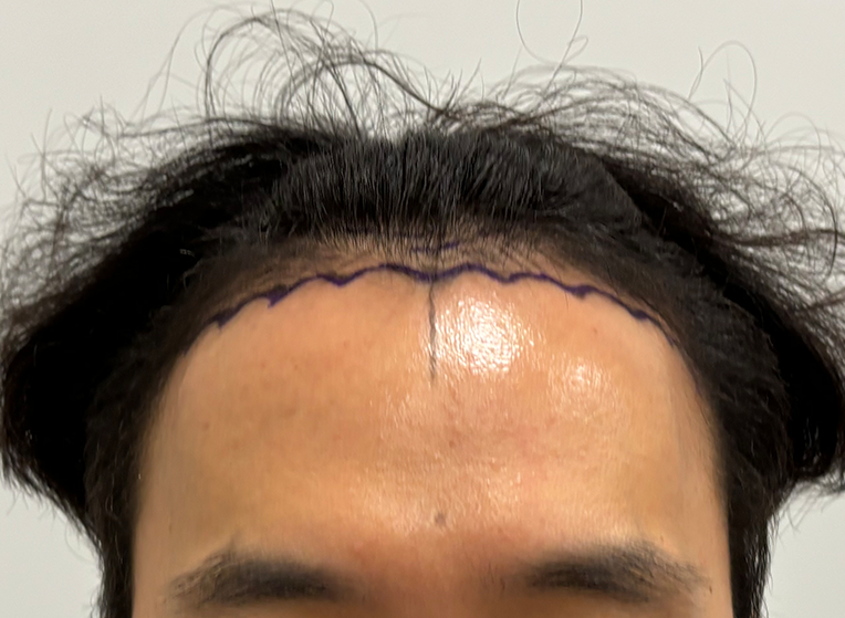 앞(전).png