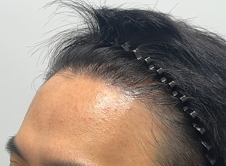 옆(후).png