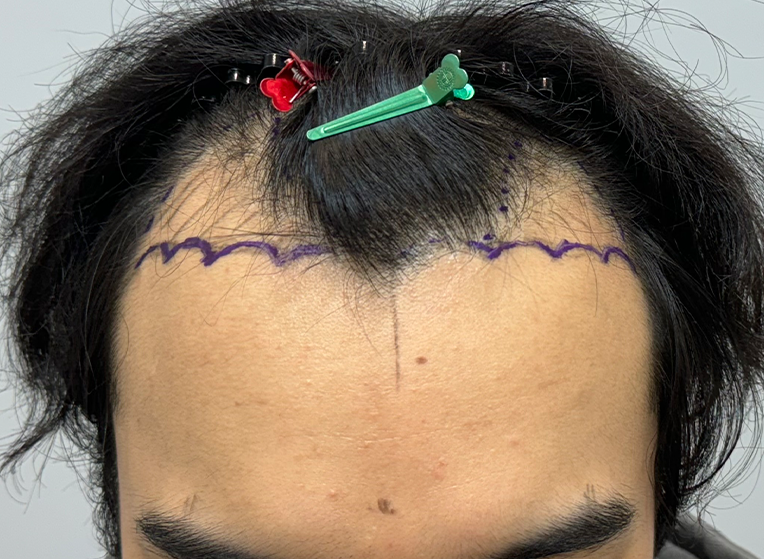 앞(전).png