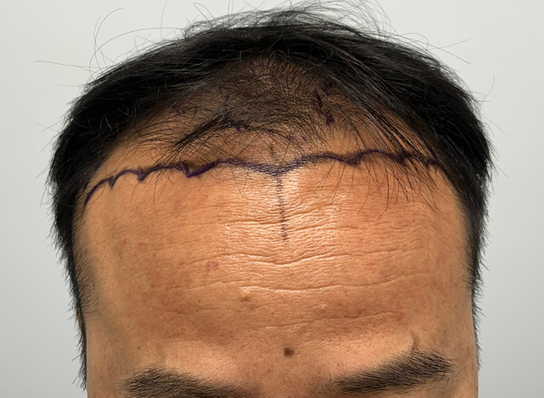 앞(전).png