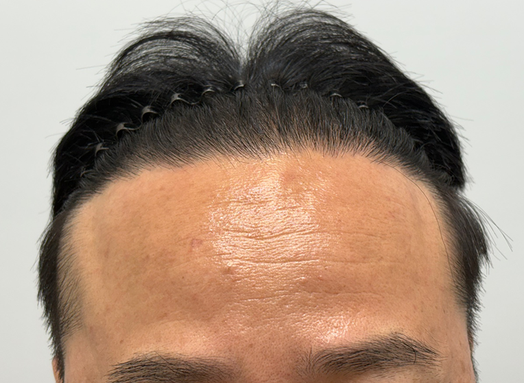 앞(후).png