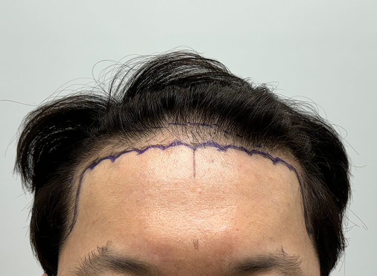 앞(전).png