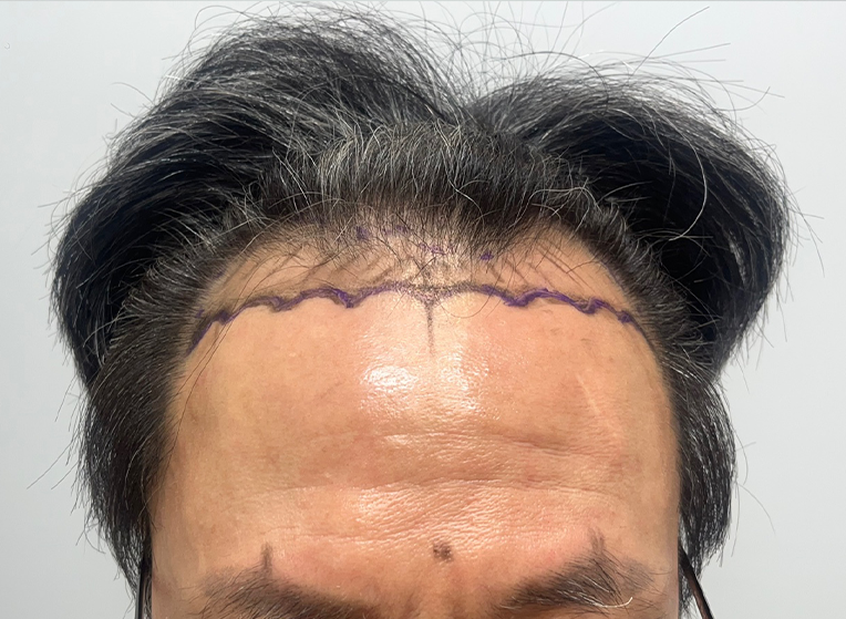 앞(전).png