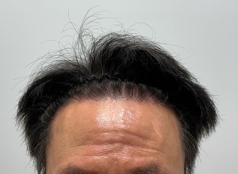 앞(후).png