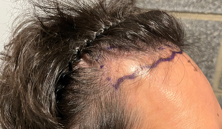 옆(전).png