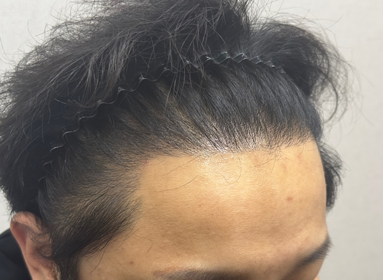옆(후).png