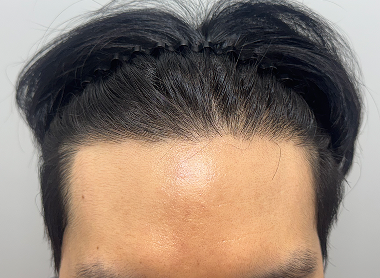 앞(후).png