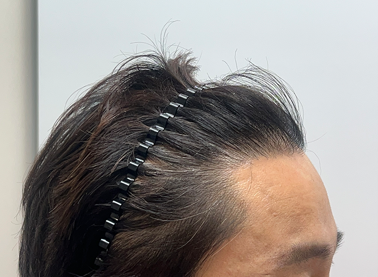 옆(후).png